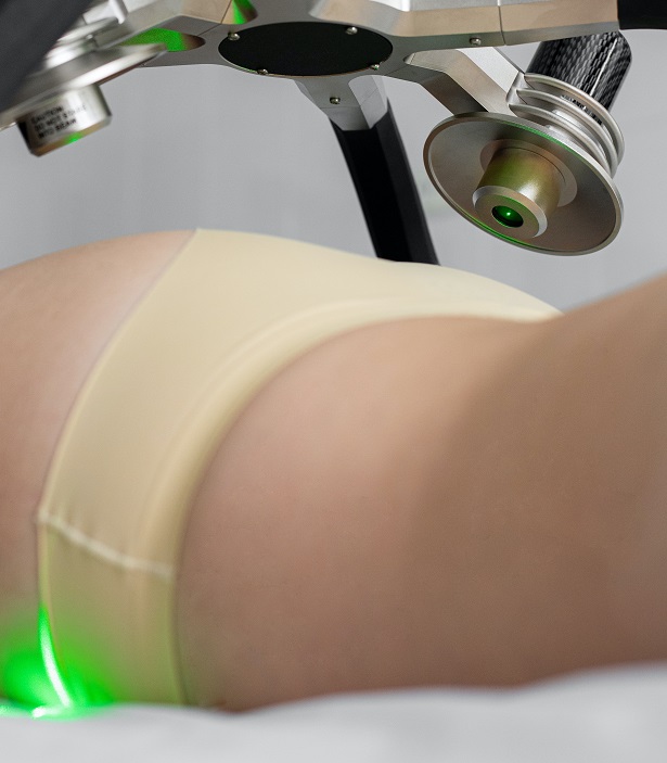 Read more about the article What are female genital radiofrequency and laser treatments?